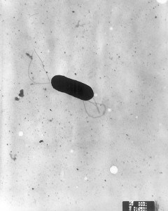 Listeria is a pathogen that may afflict pasteurized milk more than raw-milk.