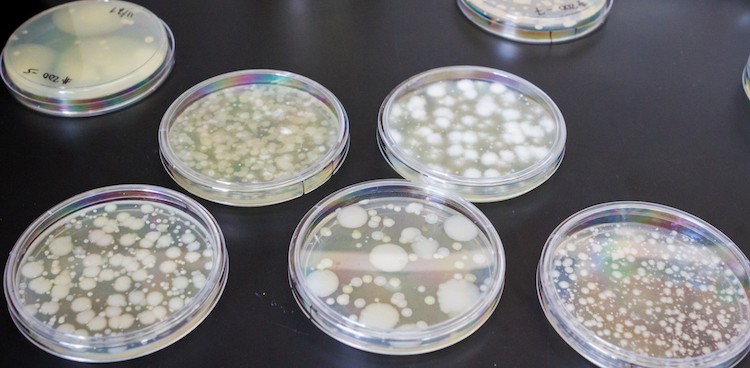 Samples from Jasper Hill farm lab
